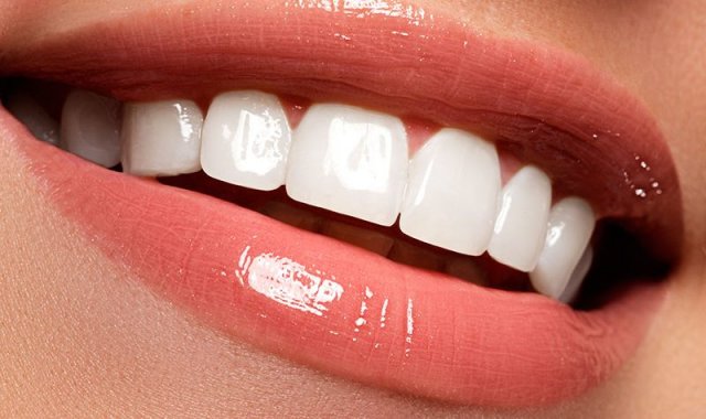 lente_de_contato_dental