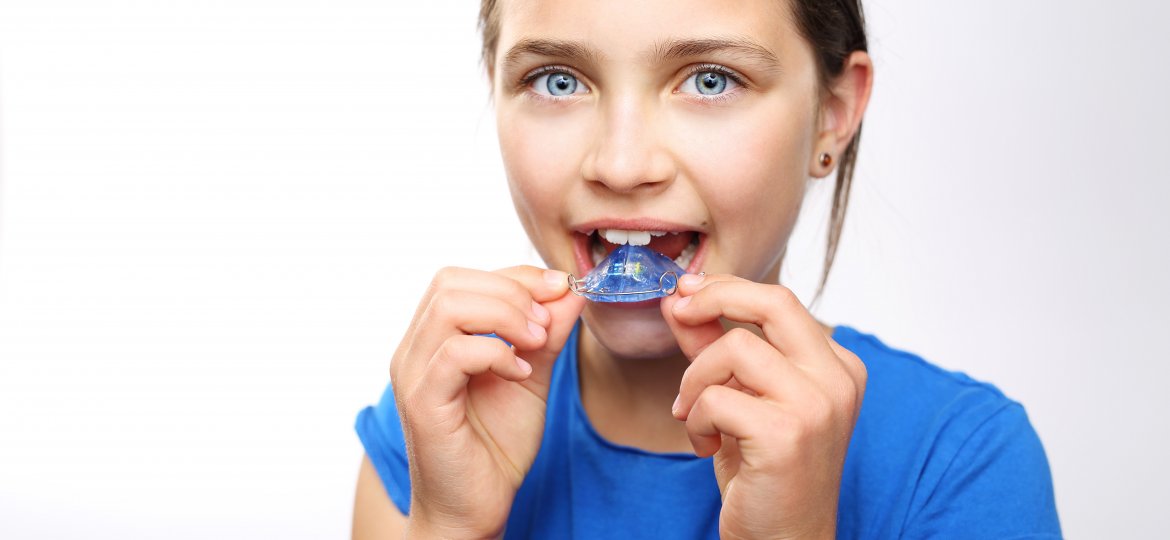 Ortodontia Preventiva