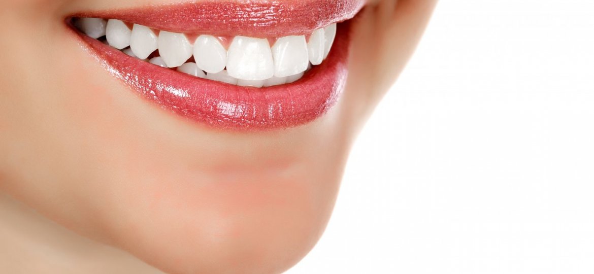 Clareamento Dental X Lentes de Contato Dental
