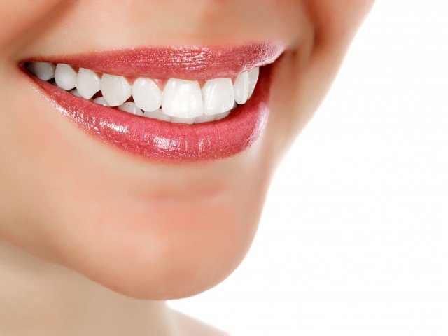 Clareamento Dental X Lentes de Contato Dental