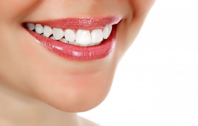 Clareamento Dental X Lentes de Contato Dental