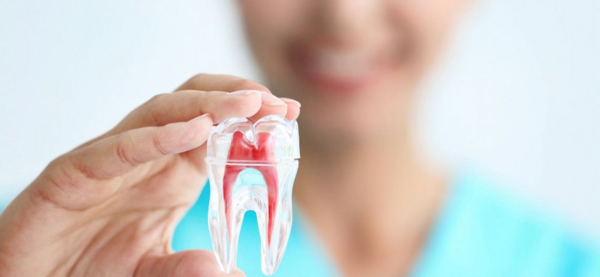 root-canal-img