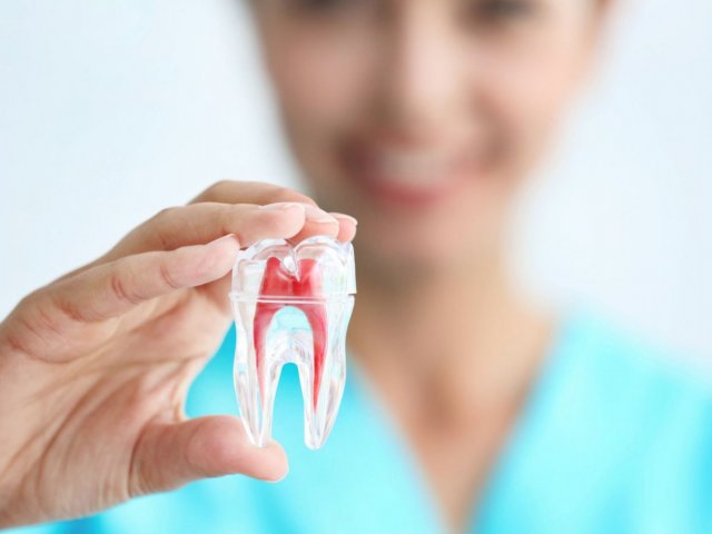 root-canal-img