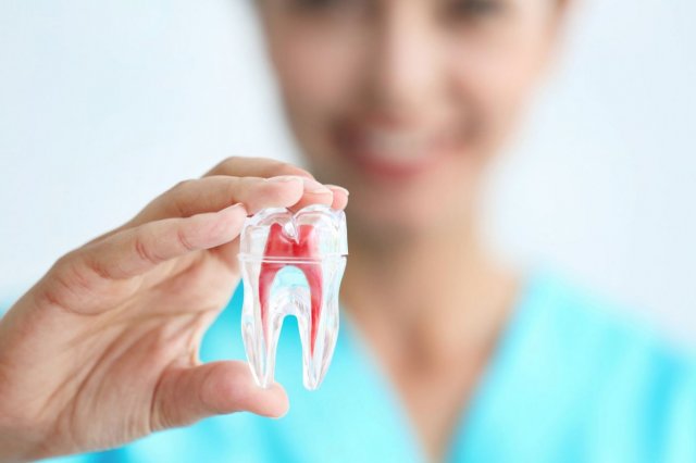 root-canal-img