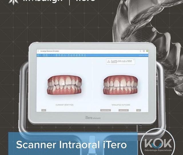 scanner intraoral