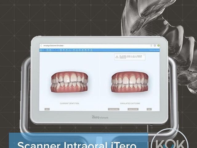 scanner intraoral