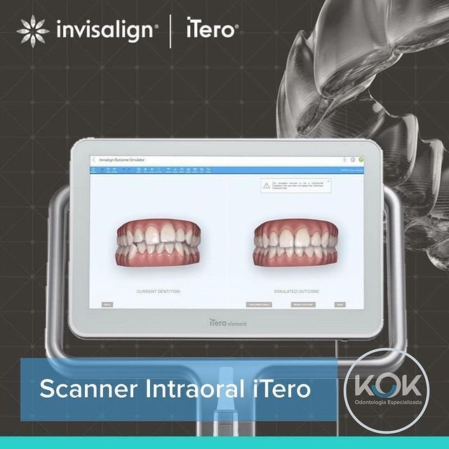 scanner intraoral