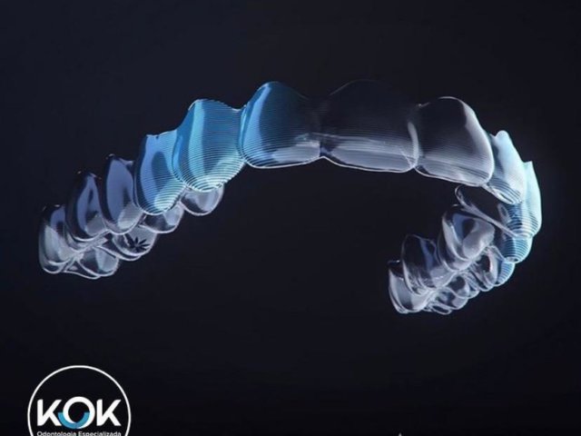 Invisalign