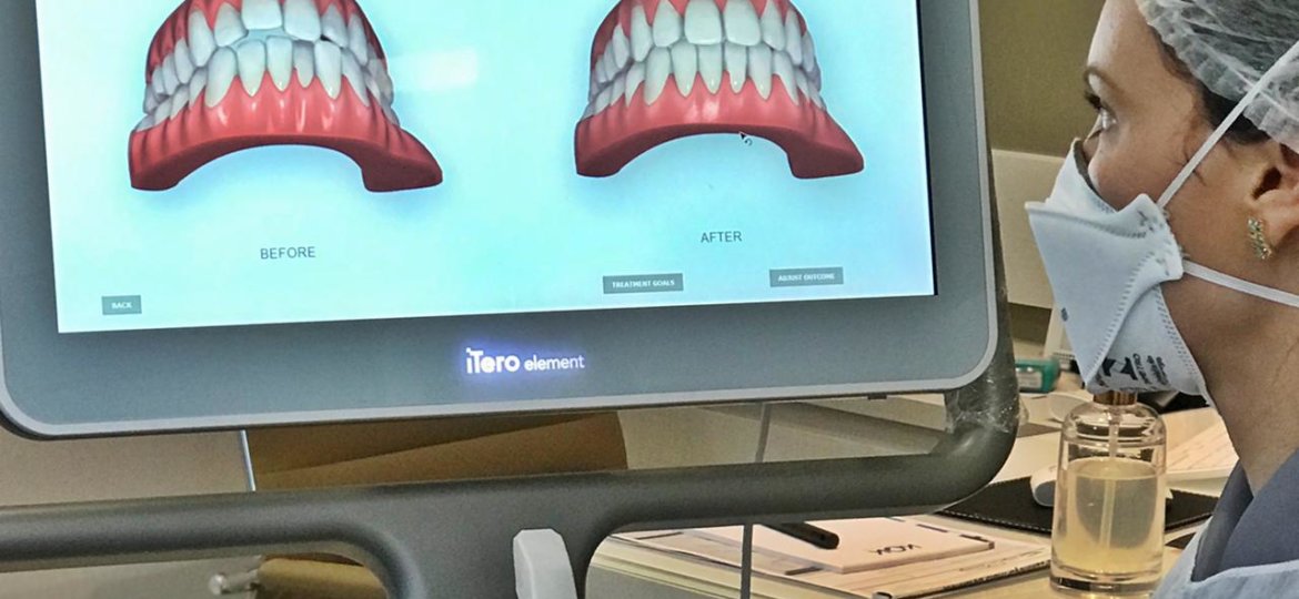 Invisalign
