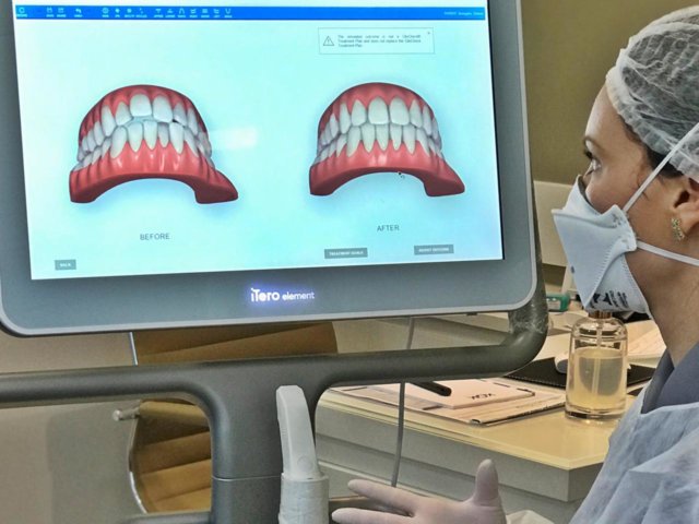 Invisalign