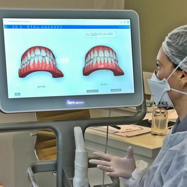 Invisalign